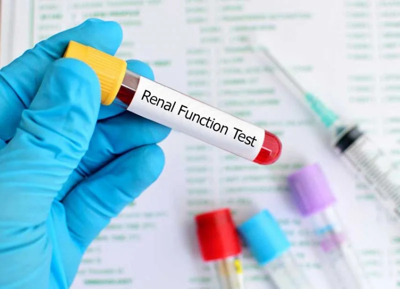 آزمون بررسی عملکرد کلیه