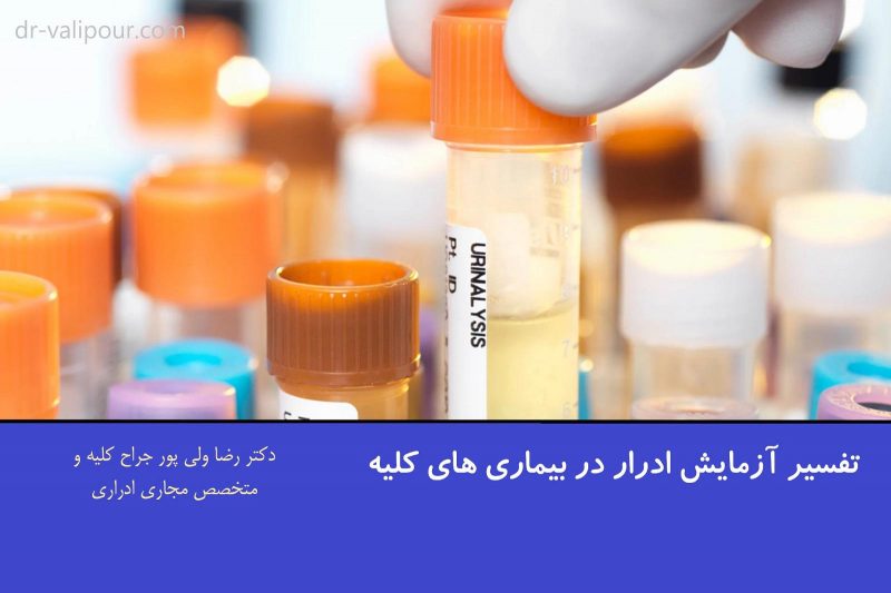 آزمایش ادرار