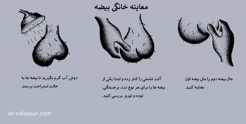 معاینه خانگی بیضه