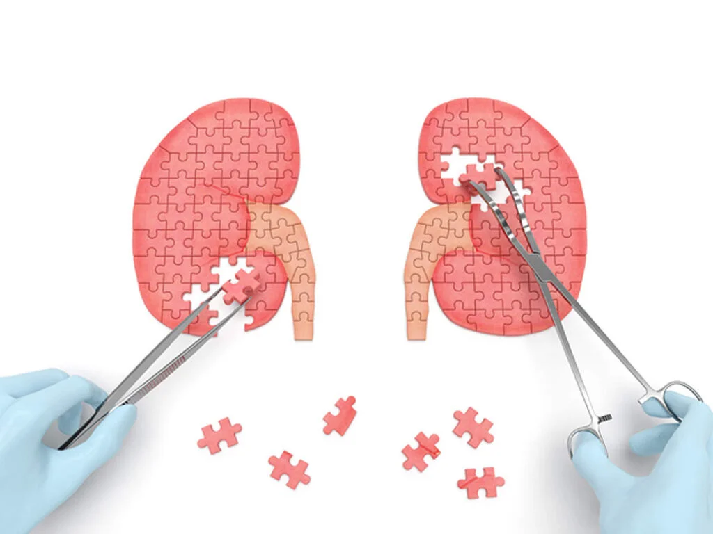 عوارض دیابت بر کلیه ها