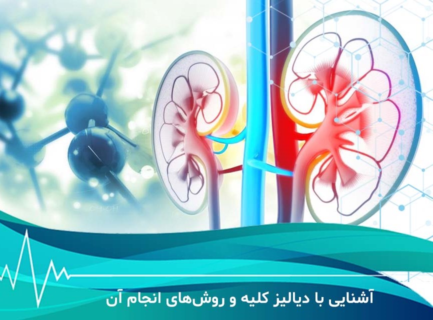 دیالیز چیست و چگونه می تواند کمک کند؟