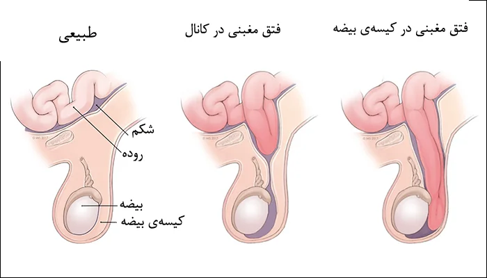 عکس بیضه سالم و ناسالم