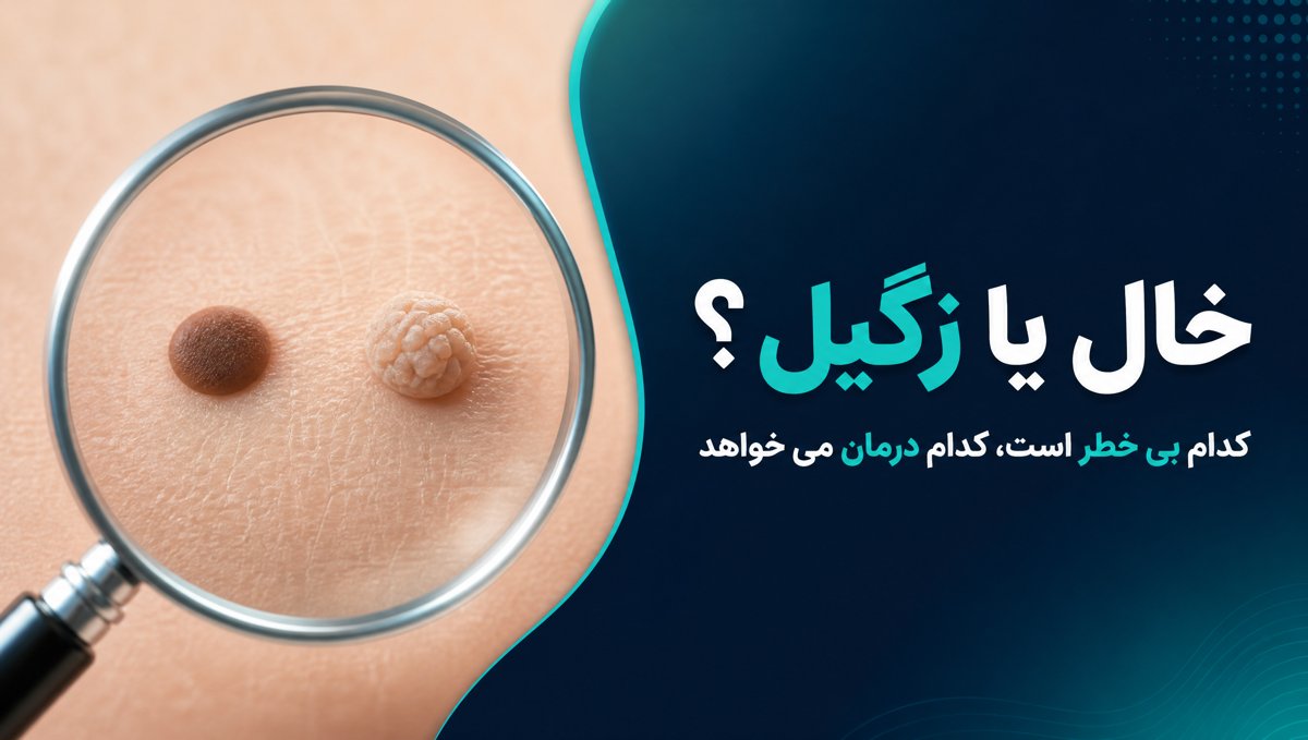 فرق خال و زگیل تناسلی